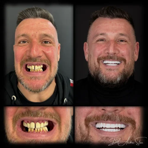 10-r13nirxmzvg2wgmj8iknfceka8fe3lr5pw7qk5cu4o