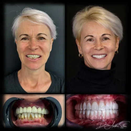 11-r13nirxmzvg2wgmj8iknfceka8fe3lr5pw7qk5cu4o