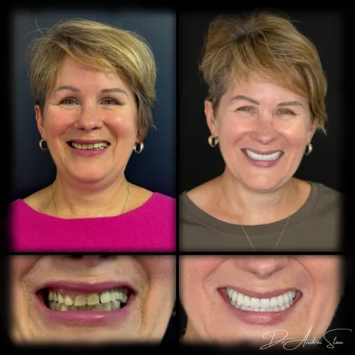 12-r13nisvh6phd82l630z9zu60vmarbauw20v81fbfyg