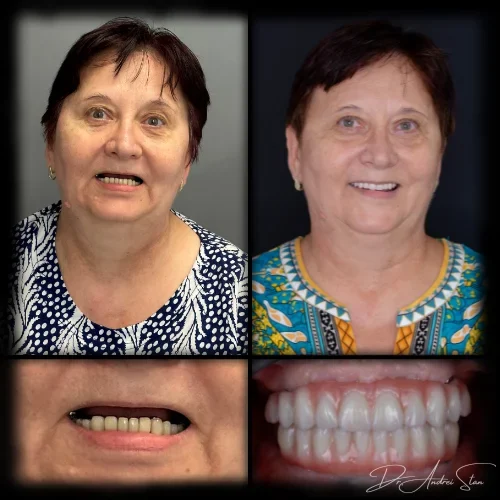 13-r13niur5kdjxvaifs1sj4toy2e1hqp2cqa66zz8nm0