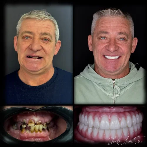 2-r13nilcro172n6w3axq9fw2c4jbtlq11cznc77mlc8