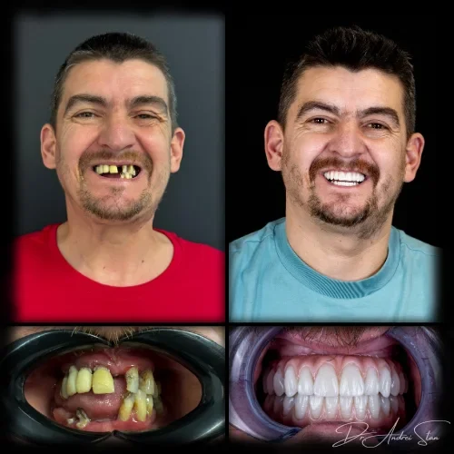 3-r13nimaluv8cysuq5g4w0dtspx76tf4rp4atohl760