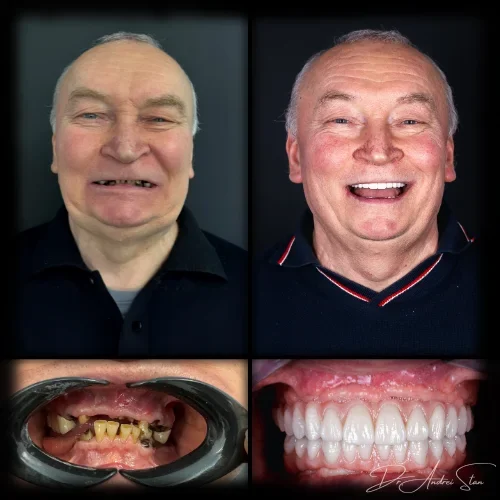 4-r13nin8g1p9naetczyjikvl9bb2k148i18yb5rjszs