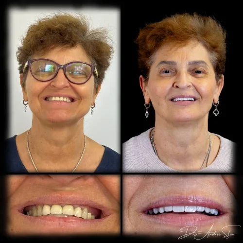 5-r13nio6a8jaxm0rzugy55dcpwoxx8tc8ddlsn1ietk