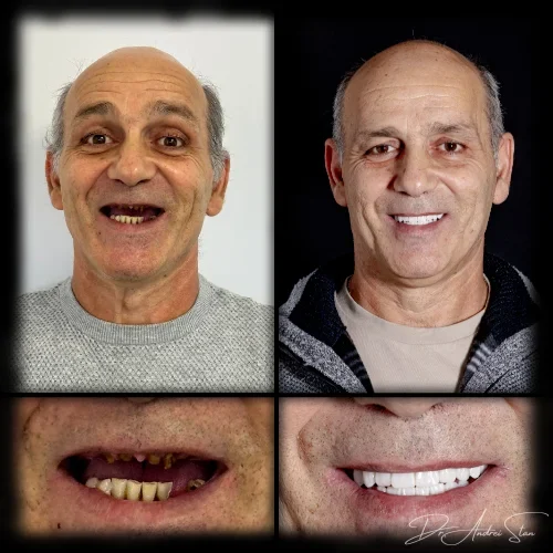 6-r13nip44fdc7xmqmozcrpv46i2tagifypi9a4bh0nc