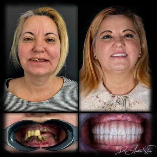 7-r13nittbdjinjojsxjdwkbxhh064izyme5ipipa1s8