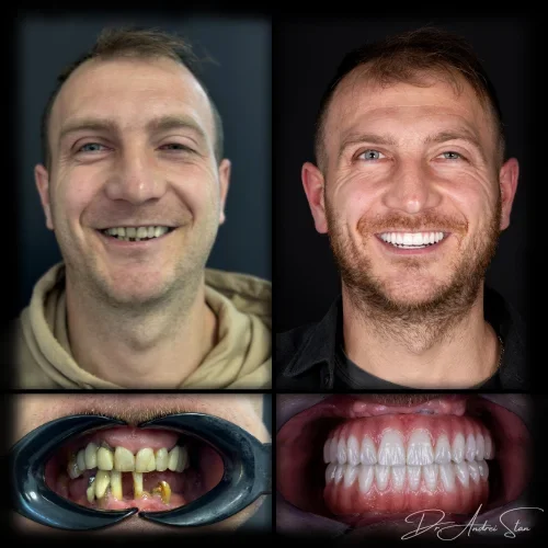 9-r13niqzst1eskunwe060uun3ouk0vwnfdrk92ve8aw